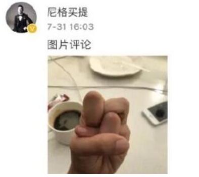一般人做不出的張一山秋水誓？醫(yī)生：這是??！