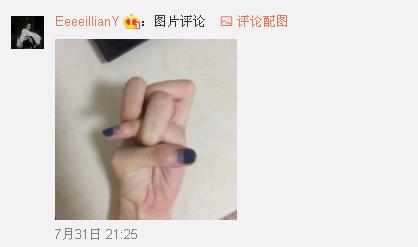 一般人做不出的張一山秋水誓？醫(yī)生：這是病！